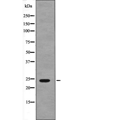 Anti-Phospho-NACA (Ser43) Polyclonal Antibody