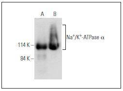 Anti-ATP1A1 Antibody (5G770)