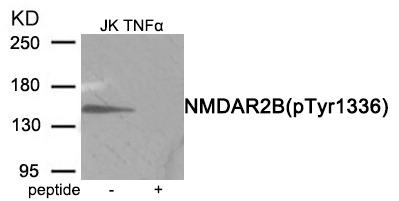 Anti-Phospho-NMDAR2B (Tyr1336) Polyclonal Antibody 2
