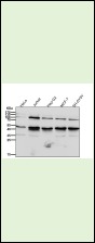 Anti-NFKB1 Antibody (3N127)