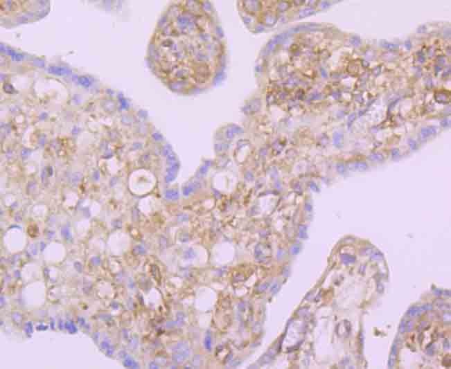 Anti-NFkB p100 Antibody (1L126)