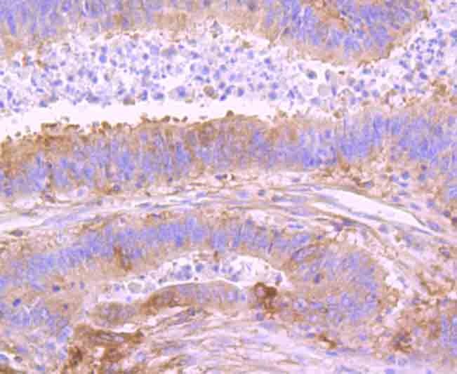 Anti-NFkB p100 Antibody (1L126)