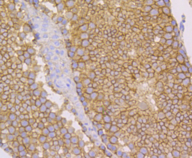 Anti-NECTIN2 Antibody (7R662)