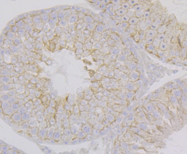 Anti-NECTIN2 Antibody (7R662)