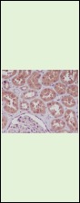 Anti-NFKB1 Antibody (3N127)