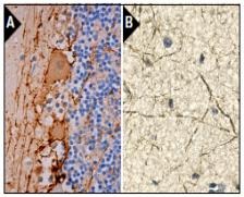 Anti-NEFH Antibody (9C4)