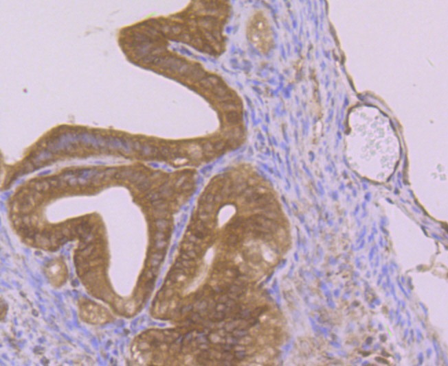 Anti-Nesprin 1 Antibody (1Z207)
