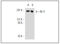 Anti-NEFH Antibody (9C4)