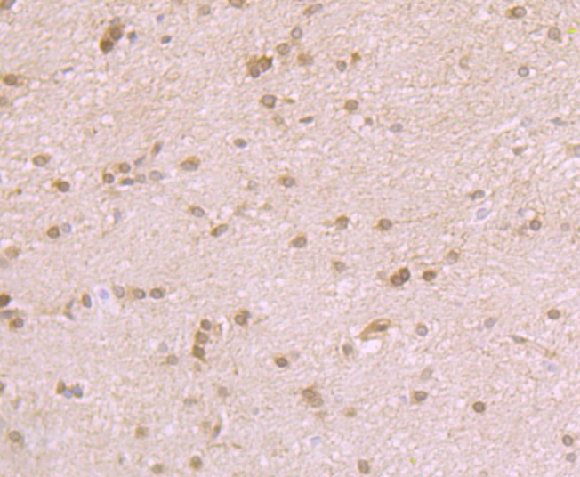 Anti-Nesprin 1 Antibody (1Z207)
