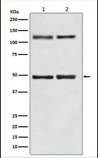 Anti-NFKB1 Antibody (3N127)