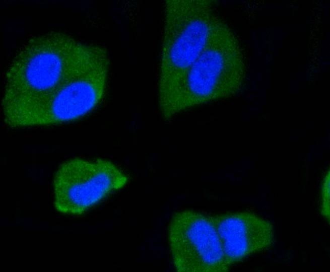 Anti-IRF1 Antibody (2Q473)