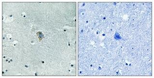 Anti-Phospho-KOR-1 (Ser369) Polyclonal Antibody