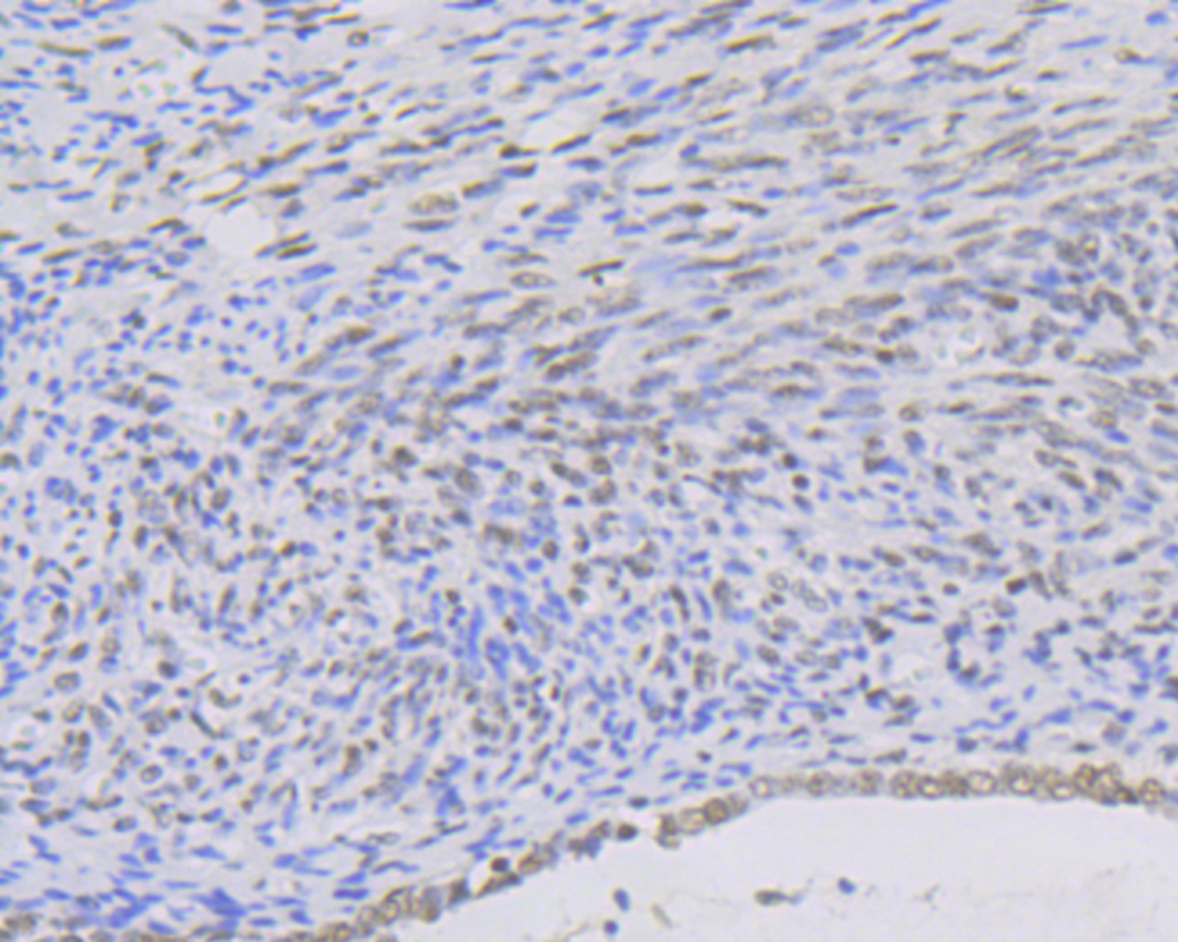 Anti-KAT8 Antibody (7Z632)