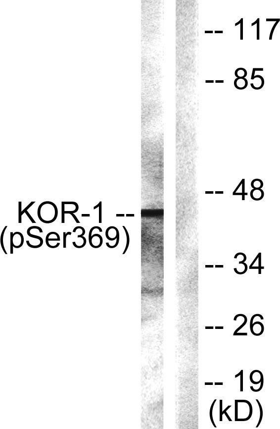 Anti-Phospho-KOR-1 (Ser369) Polyclonal Antibody