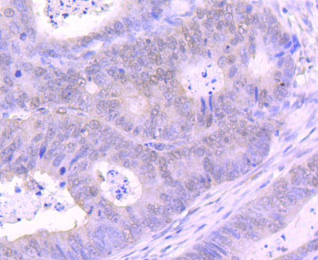 Anti-EZH2 Antibody (5A657)