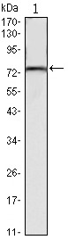 Anti-KLHL22 Antibody (5K493)