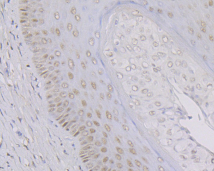 Anti-KAT8 Antibody (7Z632)