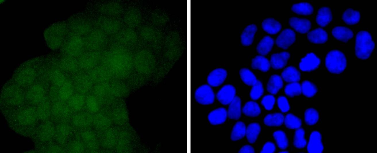 Anti-EZH2 Antibody (5A657)