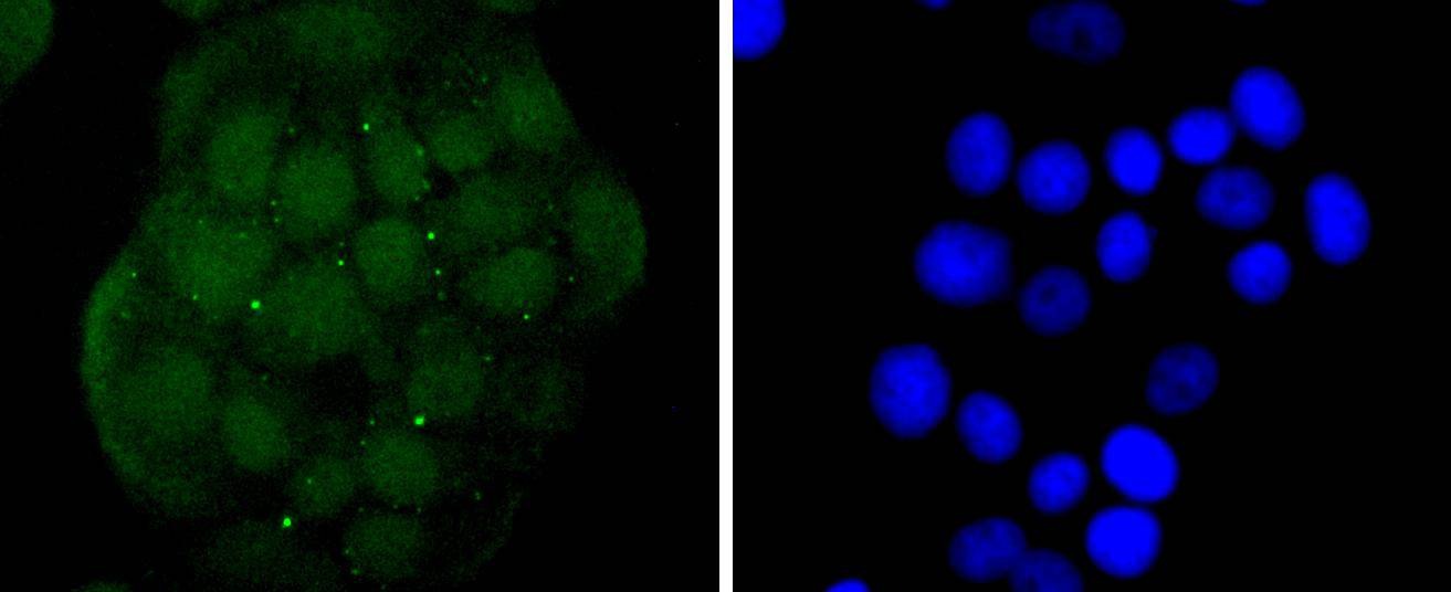 Anti-EZH2 Antibody (5A657)