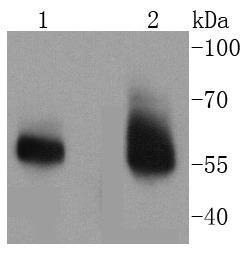 Anti-IRAK3 Antibody (3K815)