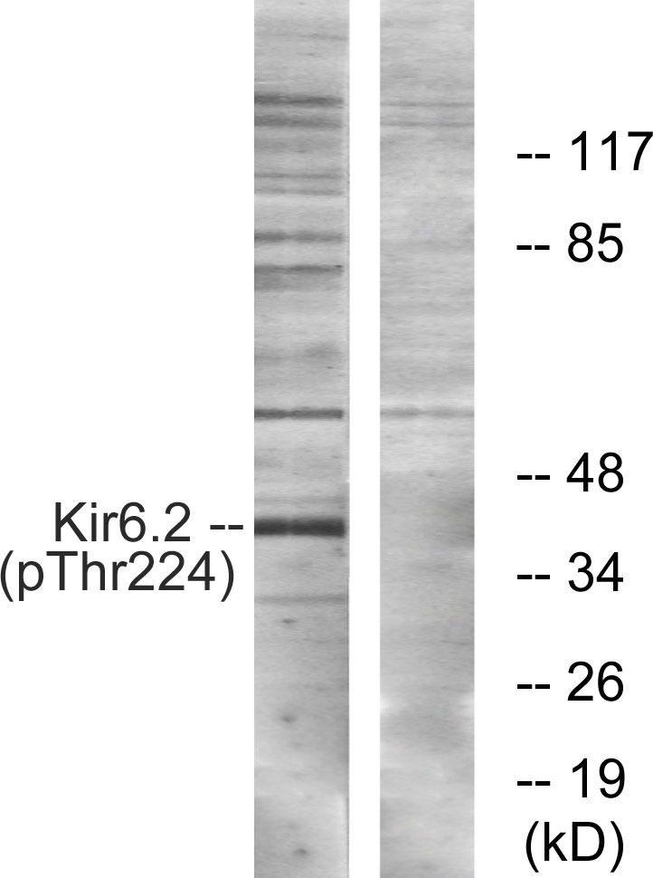 Anti-Phospho-Kir6.2 (Thr224) Polyclonal Antibody