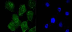 Anti-KAP1 Antibody (4I621)