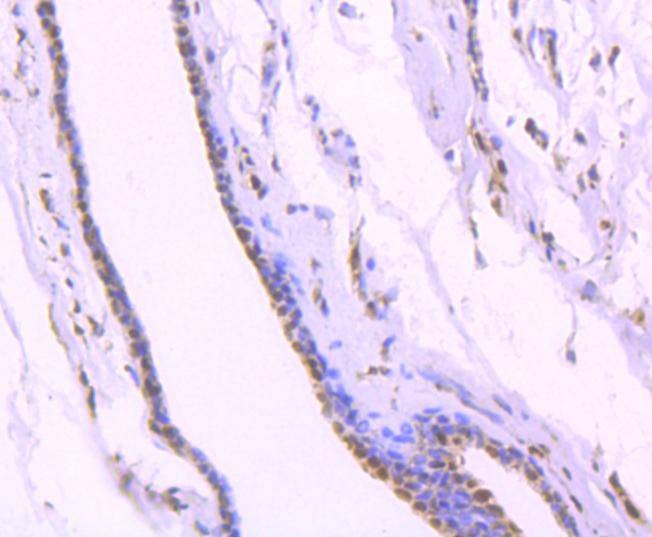 Anti-KAP1 Antibody (4I621)