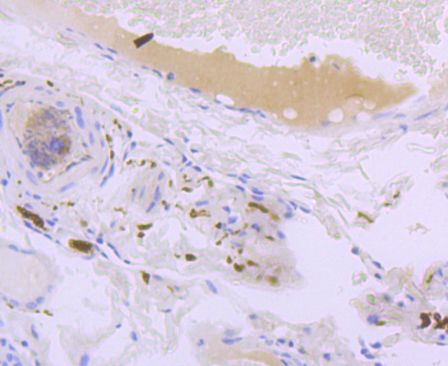 Anti-L1CAM Antibody (1P875)