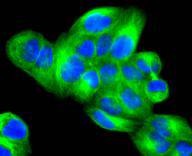 Anti-MAPK10 Antibody (7M343)