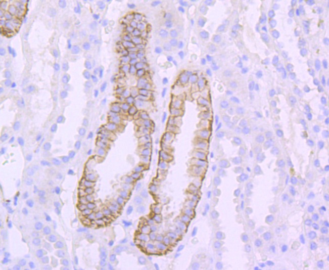 Anti-L1CAM Antibody (1P875)