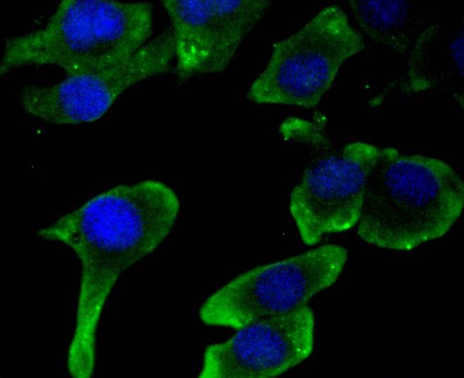 Anti-JNK2 Antibody (7P337)
