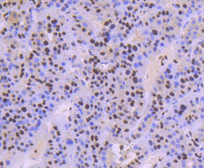 Anti-KAP1 Antibody (4I621)
