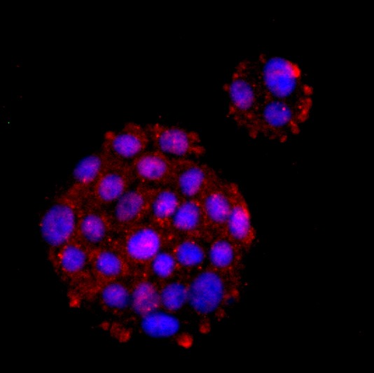 Anti-TIM-1/KIM-1/HAVCR1 Antibody (1N213)