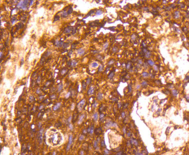 Anti-LDHA Antibody (4K270)