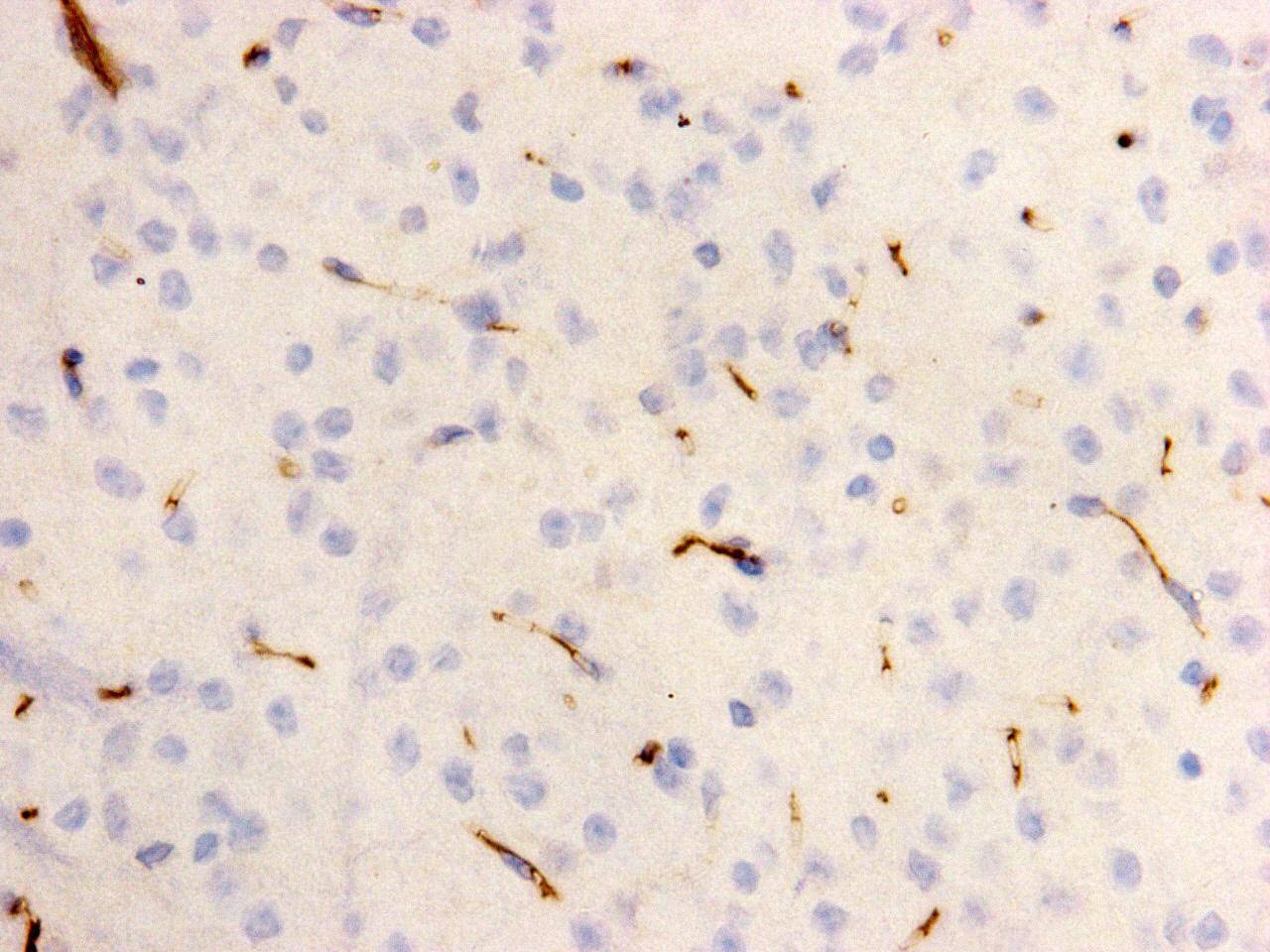 Anti-kinase D-interacting substrate 220 Antibody (6C675)