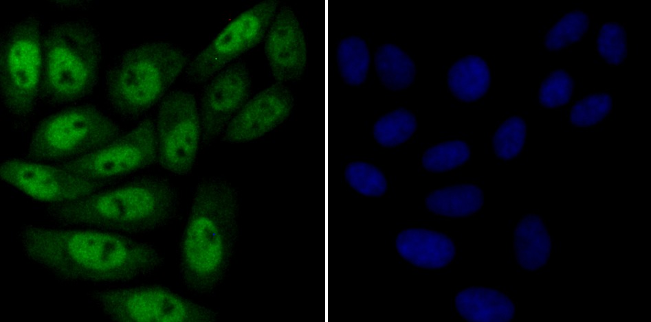 Anti-KAT8 Antibody (7Z632)