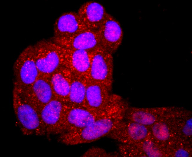 Anti-TIM-1/KIM-1/HAVCR1 Antibody (1N213)