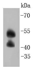 Anti-JNK2 Antibody (7P337)