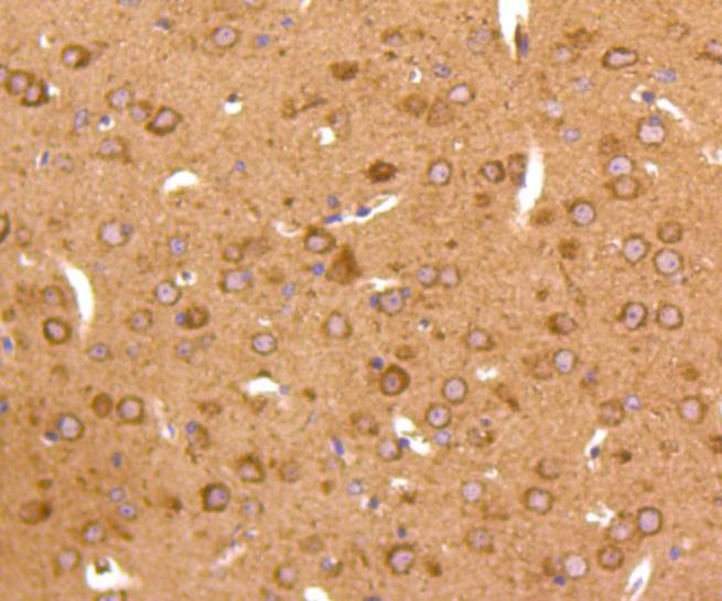 Anti-JNK2 Antibody (7P337)