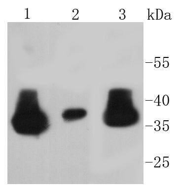 Anti-LDHA Antibody (4K270)