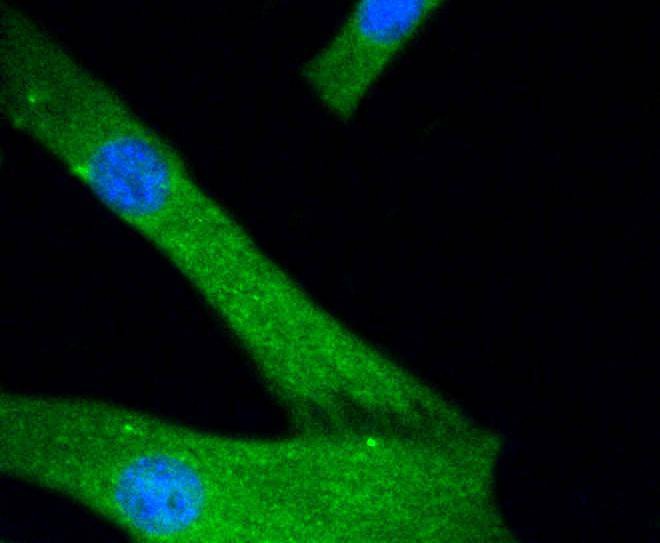 Anti-JNK1/2/3 Antibody (6S831)