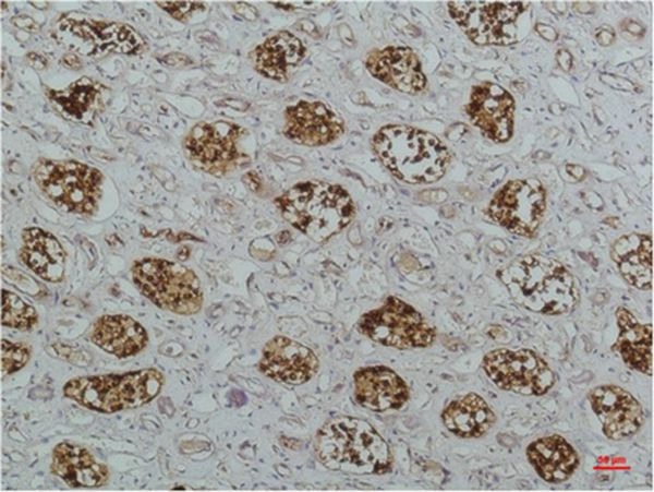 Anti-IκB β Antibody (1Z750)