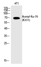 Anti-Acetyl-Ku70 (Lys331) Polyclonal Antibody
