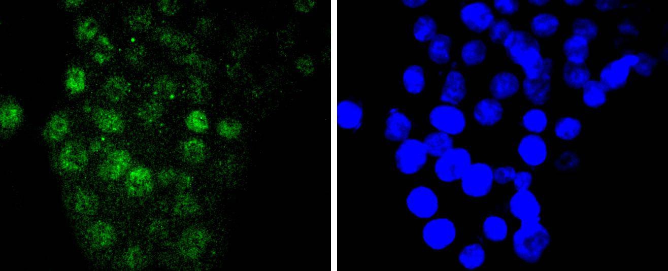 Anti-IRF6 Antibody (5K34)