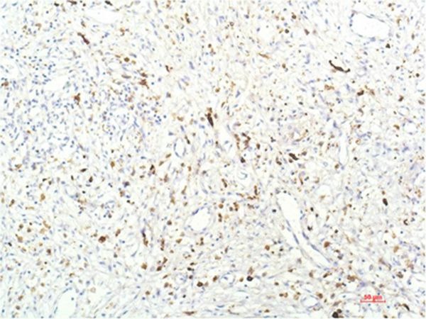 Anti-JAK1 Antibody (1F359)
