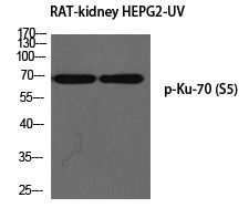 Anti-Phospho-Ku70 (Ser5) Polyclonal Antibody