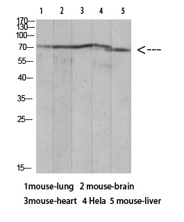 Anti-Acetyl-Ku70 (Lys317) Polyclonal Antibody