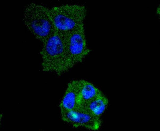 Anti-IRF5 Antibody (2A61)