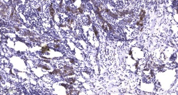 Anti-Phospho-LATS1/2 (Ser909) Polyclonal Antibody