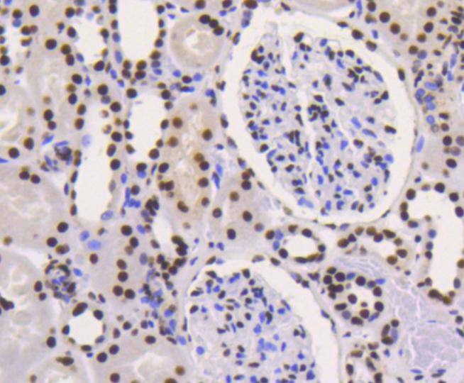 Anti-XRCC5 Antibody (9O180)